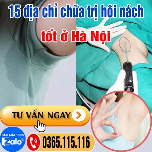 15 địa chỉ chữa hôi nách, cắt tuyến mồ hôi nách tốt nhất Hà Nội 15 địa chỉ chữa hôi nách, cắt tuyến mồ hôi nách tốt nhất Hà Nội